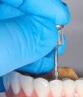 Oral and Maxillofacial Surgery