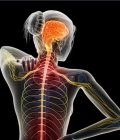 Brain and Spine Surgery (Neurosurgery) in Türkiye | MPGCARE