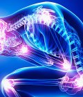Pain Clinic (Algology) in Türkiye | MPGCARE