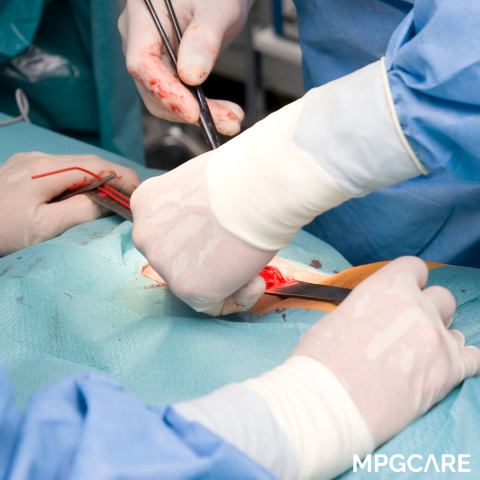 MPGCare Medical Park Kasık Fıtığı Belirtileri Erkeklerde