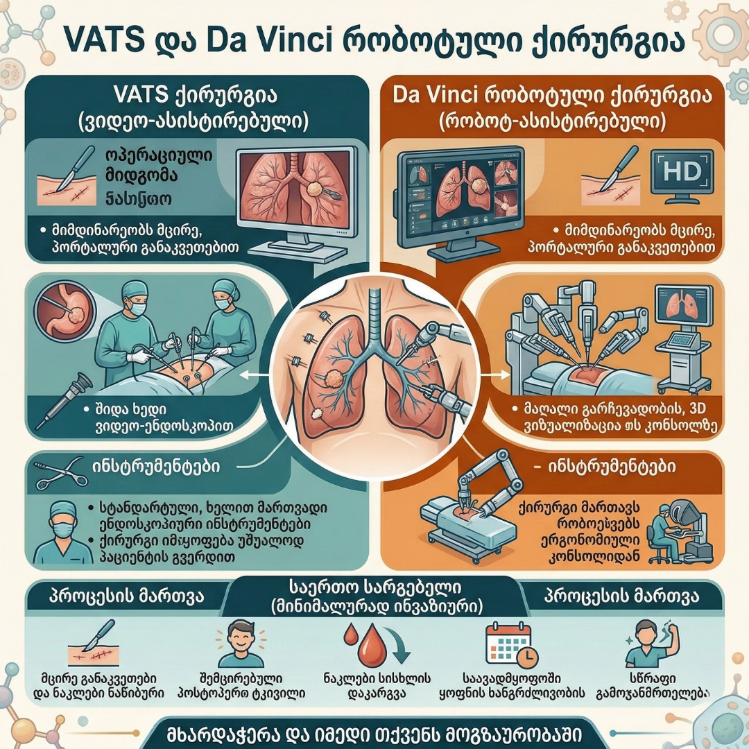 MPGCare Medical Park VATS ქირურგია